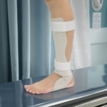 Lower Limb External Fixation Splint Series - 图片 6
