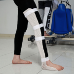 Lower Limb External Fixation Splint Series