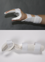 Hand splint - 图片 7