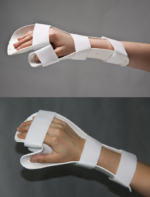 Hand splint - 图片 4