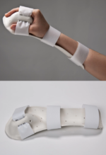 Hand splint - 图片 3