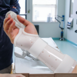 Hand splint fracture - 图片 3